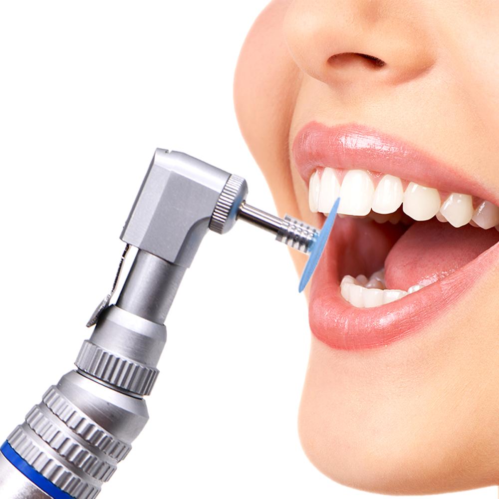 Чистка полировка зубов. Профессиональная гигиена полости рта. Шлифование в стоматологии.